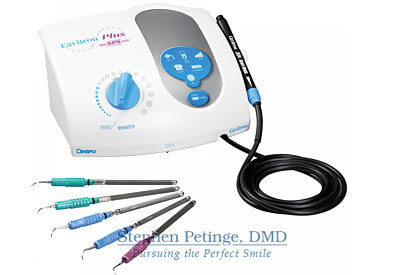 ultra sonic scaler